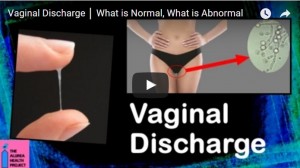 vaginal health discharge problem