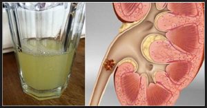 Drinking-Half-Cup-Of-Lemon-Juice-Can-Make-Your-Kidney-Healthier