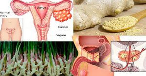 Ginger-Can-Fight-Prostate,-Ovarian-And-Colon-Cancer_1