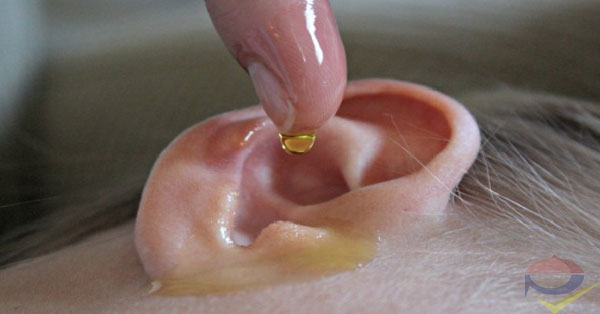 this-alcohol-and-vinegar-solution-is-better-in-removing-earwax-than-cotton-swabs