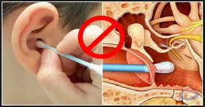 This Ingredients Is Better Solution In Removing Earwax Than Cotton Swabs
