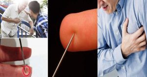 Here’s-How-You-Can-Save-a-Person-Suffering-from-Stroke-by-Using-a-Needle