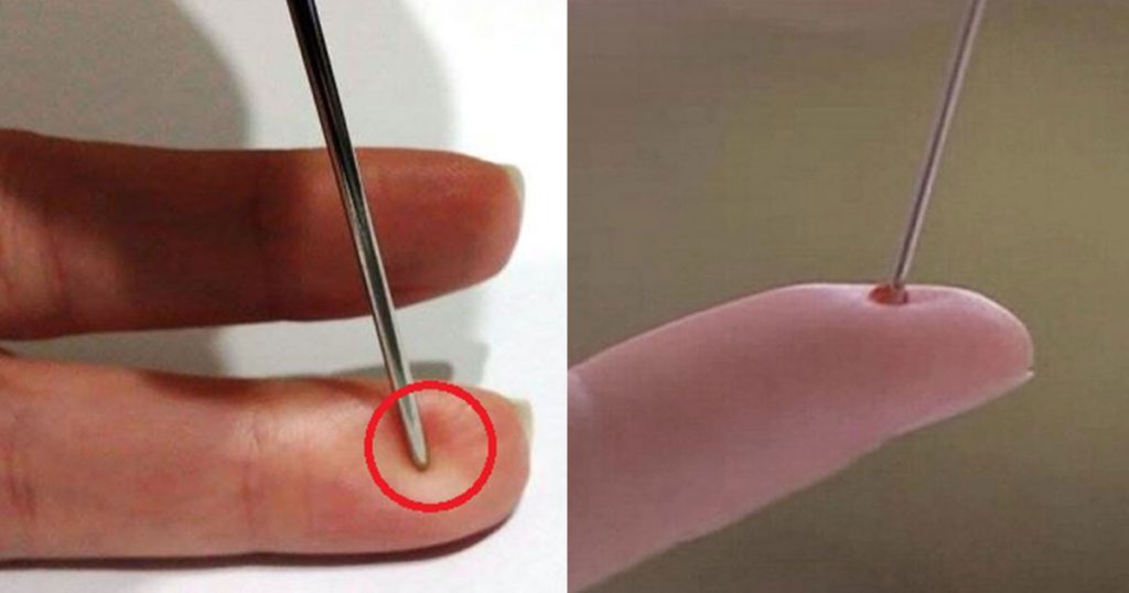Save-a-Person-Suffering-from-Stroke-by-Using-a-Needle